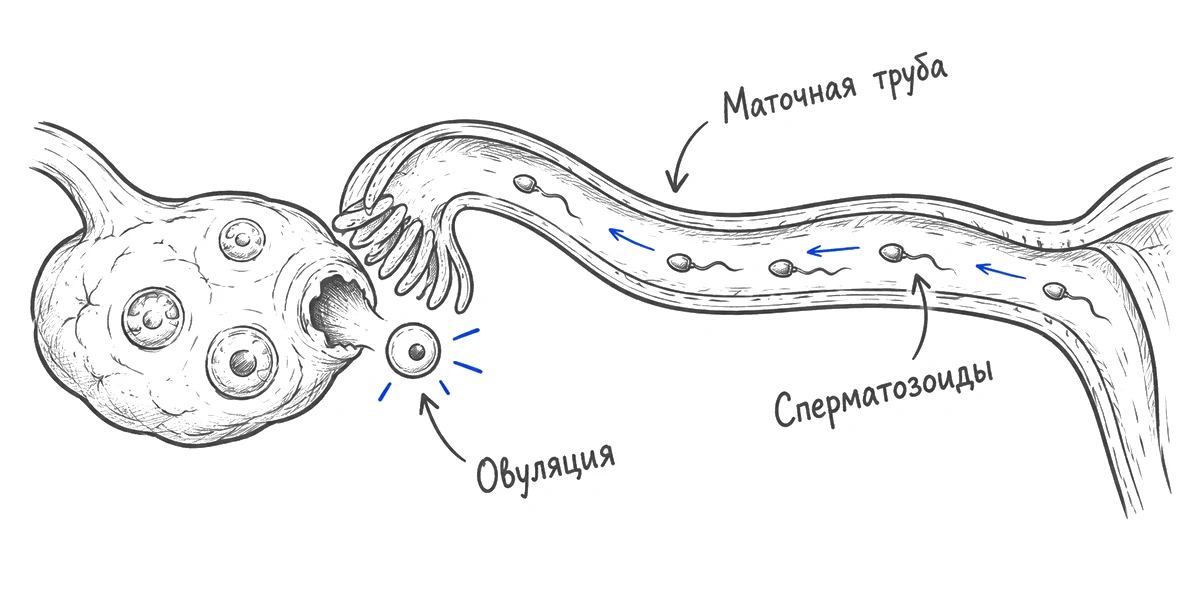 Яйцеклетка и сперматозоиды в маточной трубе.